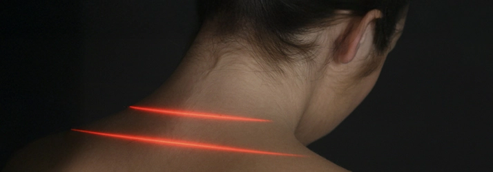 Chiropractic Guntersville AL MLS Laser Therapy Person with red laser lined on their neck.