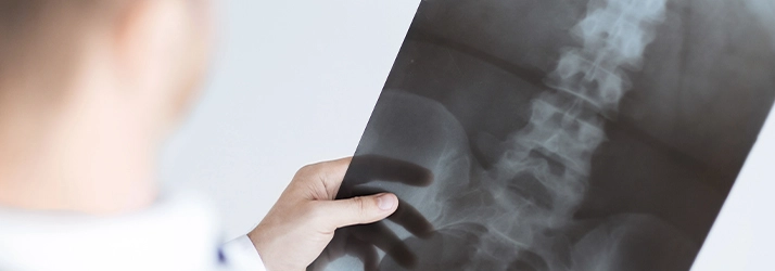 Chiropractic Huntsville AL Digital X-Rays Person holding a X-Ray.